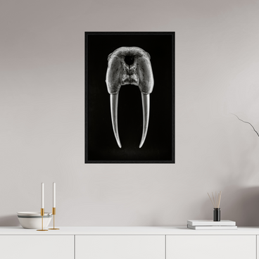 20 x 30″, L+XL Black Floater Frame DENTAL PLAN