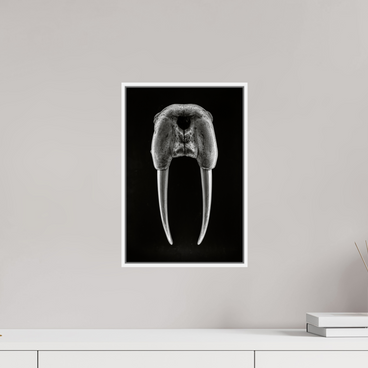 10 x 15″, S+M White Floater Frame DENTAL PLAN