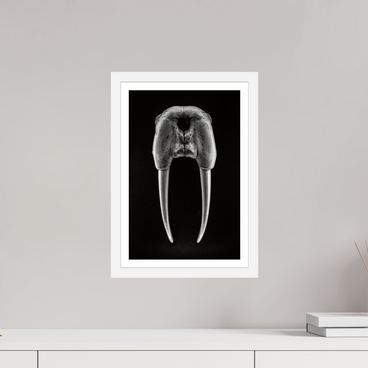 10 x 15″, S+M White Frame + Border DENTAL PLAN
