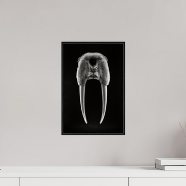 10 x 15″, S+M Black Floater Frame DENTAL PLAN