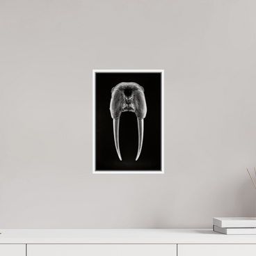 8 x 12″, S+M White Floater Frame DENTAL PLAN