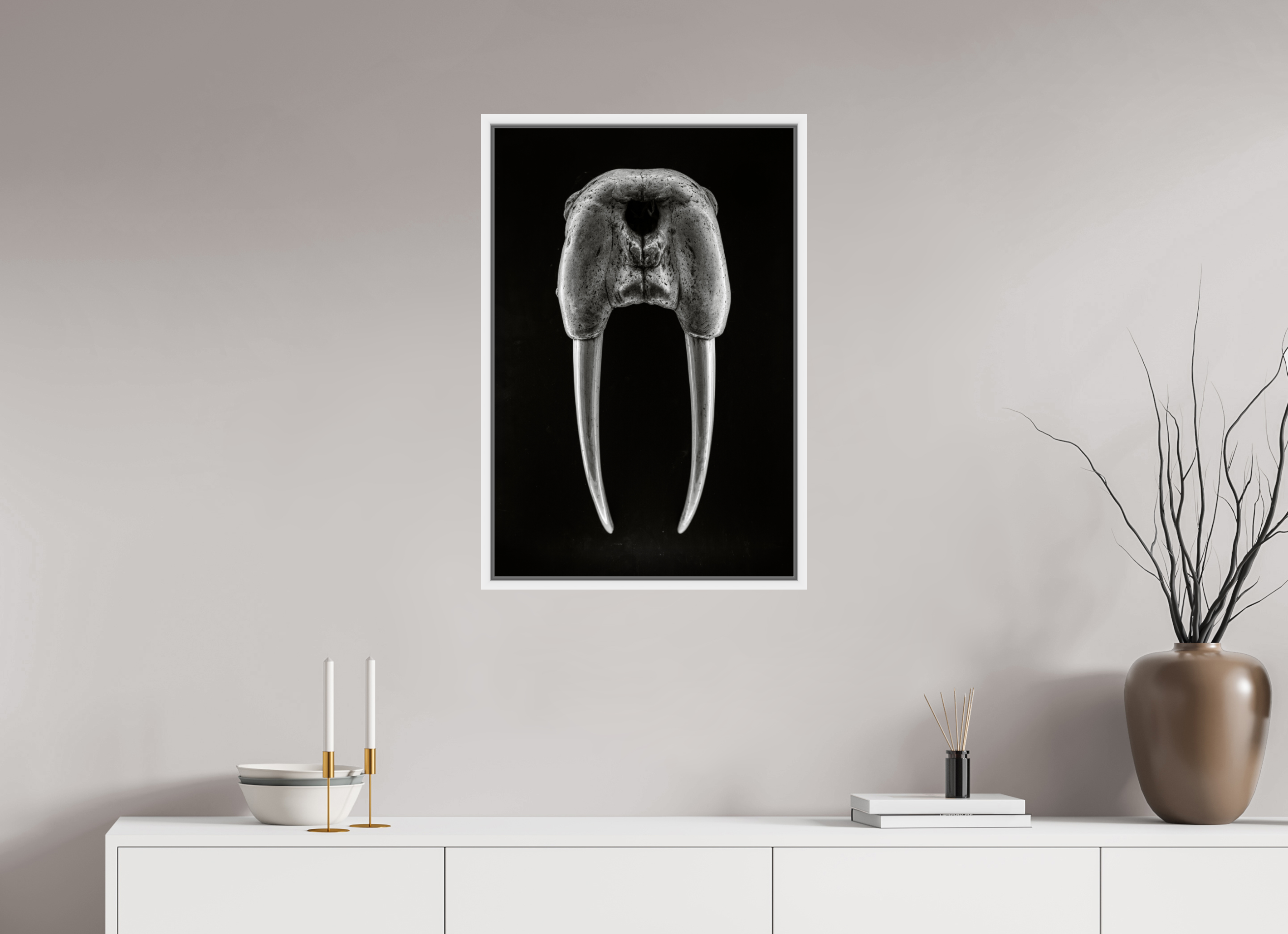 20 x 30″, L+XL White Floater Frame DENTAL PLAN