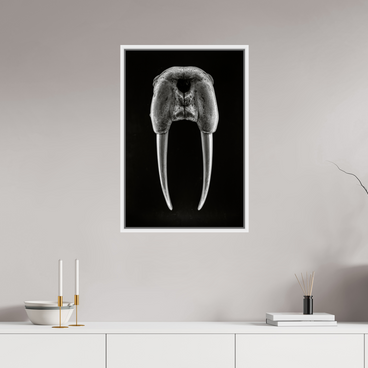 20 x 30″, L+XL White Floater Frame DENTAL PLAN